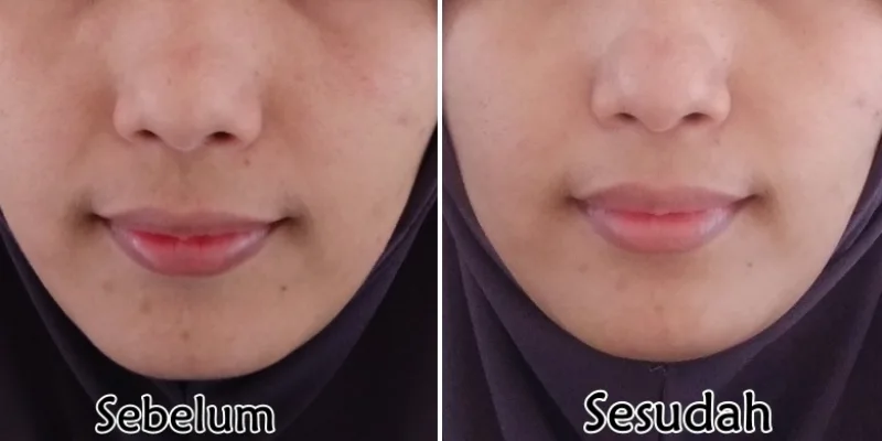 review pemakaian serum scarlett