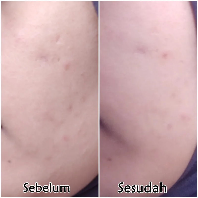 review pemakaian serum scarlett